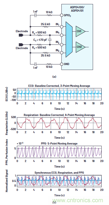 多參數生命體征監測比以往任何時候都更容易