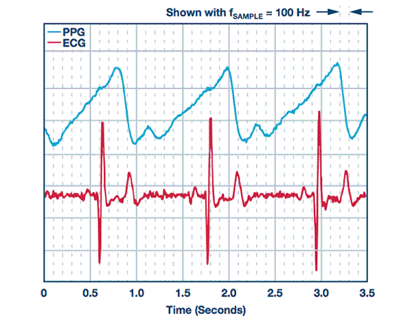 從可穿戴設(shè)備過(guò)渡到醫(yī)療設(shè)備 從可穿戴設(shè)備過(guò)渡到醫(yī)療設(shè)備